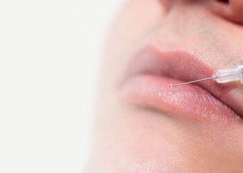 ¡ALERTA SANITARIA EN MÉXICO! Riesgo por falso rellenador de labios