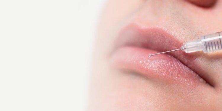 ¡ALERTA SANITARIA EN MÉXICO! Riesgo por falso rellenador de labios
