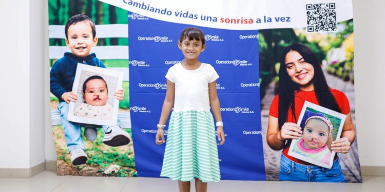 Realizan Fundación Smile y DIF Tamaulipas cirugías de paladar hendido y labio leporino