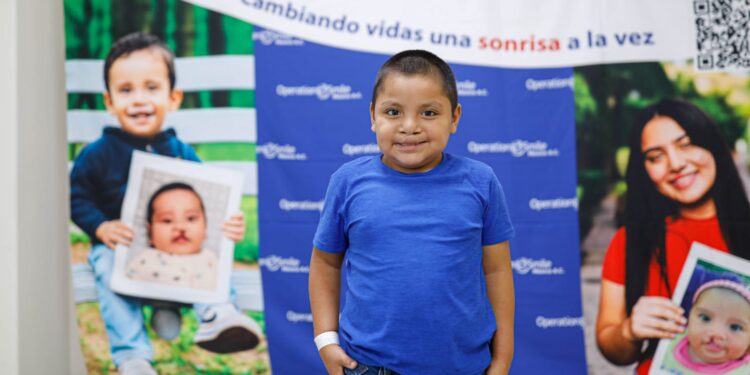 Realizan Fundación Smile y DIF Tamaulipas cirugías de paladar hendido y labio leporino