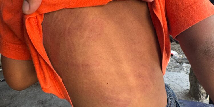 Guardia Estatal de Género atiende reporte de violencia contra menor