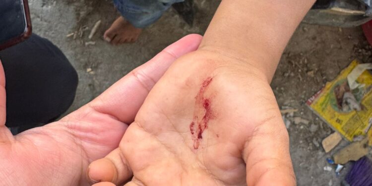 Guardia Estatal de Género atiende reporte de violencia contra menor