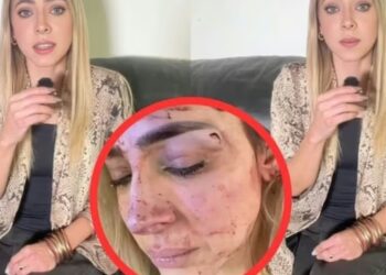 Edna Monroy exhibe pruebas de agresión: «Me aventó por las escaleras y me asfixió»