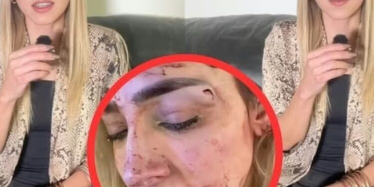 Edna Monroy exhibe pruebas de agresión: «Me aventó por las escaleras y me asfixió»