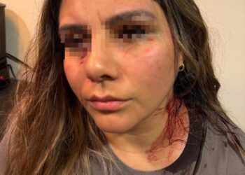 ​Terror en el alojamiento: Mujer denuncia brutal agresión y amenazas en Airbnb de Tampico