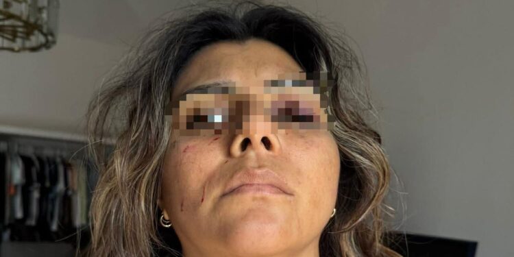 ​Terror en el alojamiento: Mujer denuncia brutal agresión y amenazas en Airbnb de Tampico